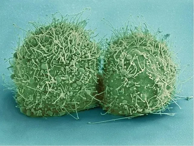 图：刚分裂的海拉细胞