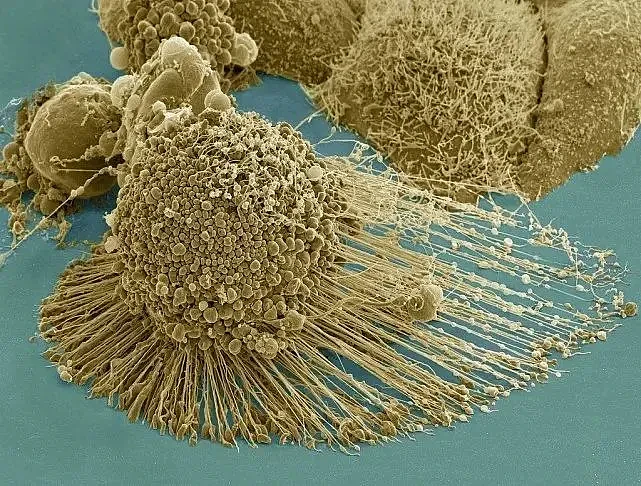 图：凋亡海拉细胞