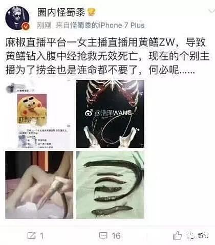 头皮发麻！网曝一女子为求刺激将黄鳝塞入身体，医生取出时感叹：还是活的（视频/组图） - 5