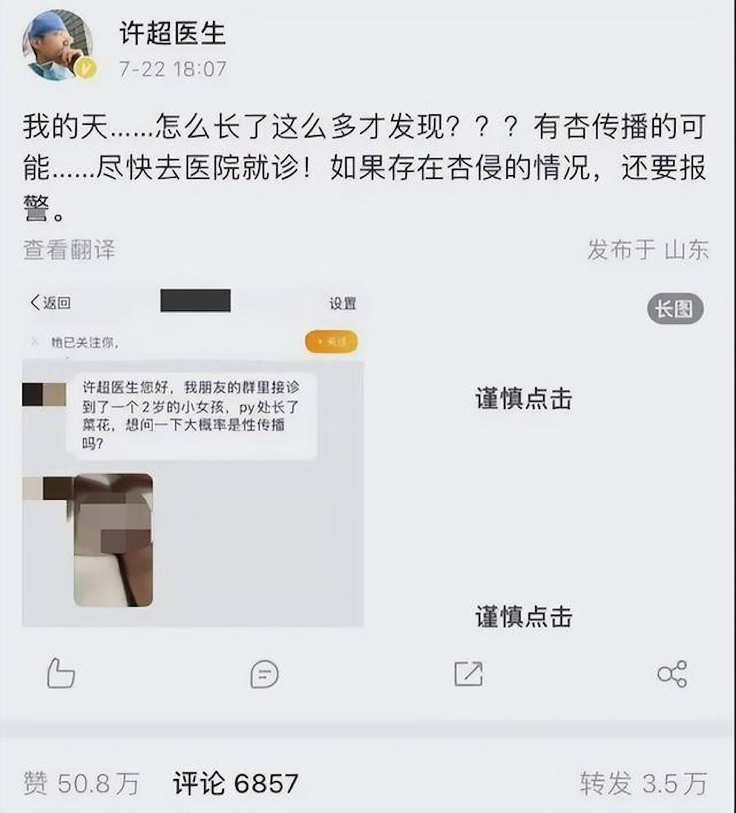许超医生在微博发布一张截图，揭露有粉丝反映贵州安顺2岁女童肛周长满「菜花」。 （微博）