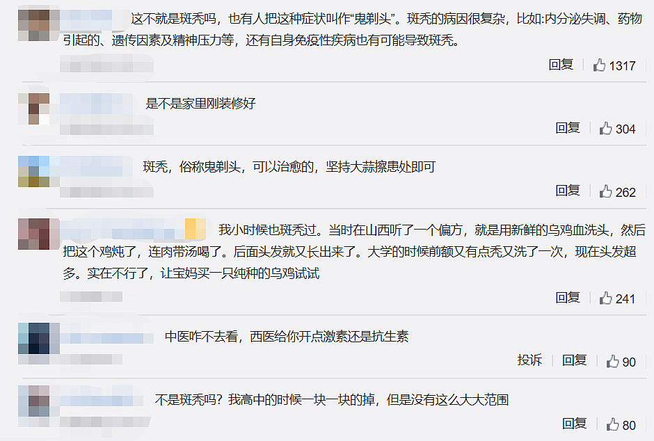 2岁男童怪异脱发一碰就掉，母亲急哭：像地图一样（组图） - 2