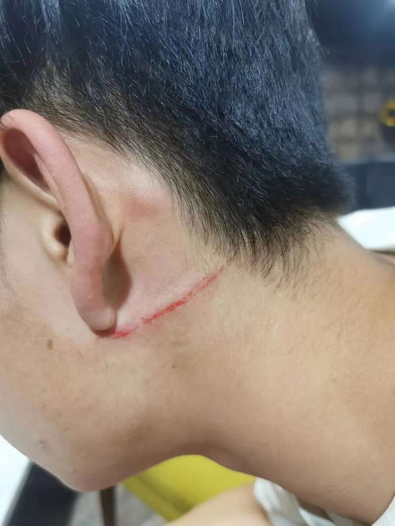 又有中国留学生剑桥遭围殴，被饮料罐砸伤留伤疤（组图） - 10