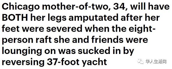 恐怖！亚裔女子游湖被吸入船底 双腿遭游艇螺旋桨切断（组图) - 1