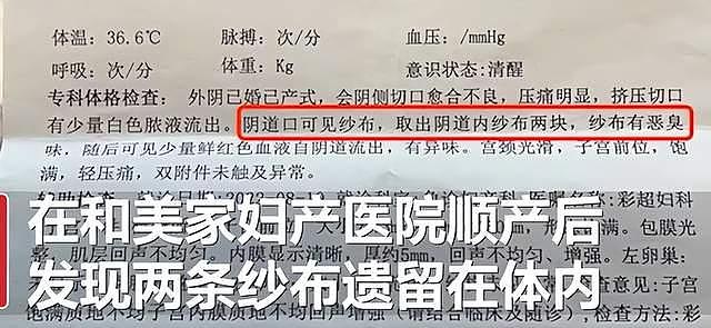 女子产后，2块纱布被遗留体内，官方确认：院方人员疏忽（组图） - 2