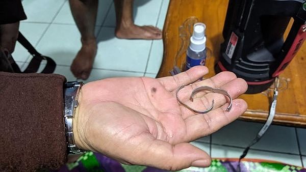 ▲▼印尼一名男子将戒指卡在生殖器上无法取消，最后不得不尴尬地向消防局求助。 （图／翻摄自推特）