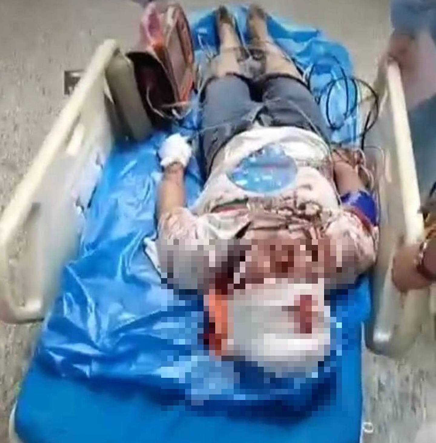 网传女子送医影片，头部受伤。 内地网民指出，唐山被打女子共有4名，但都无后续消息。 （抖音）