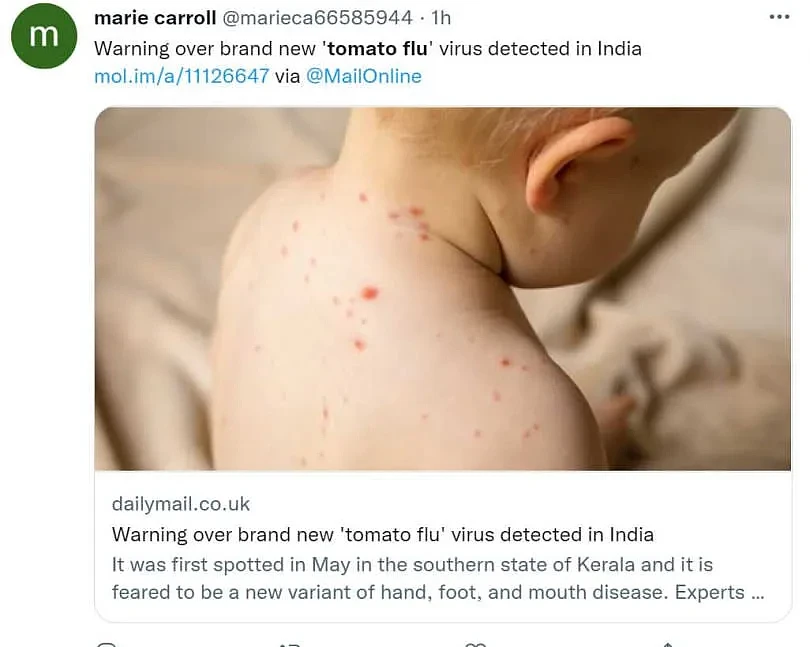 感染「番茄流感」的儿童皮肤会出现像番茄一样的红疹和水泡。 （图／翻摄自推特）