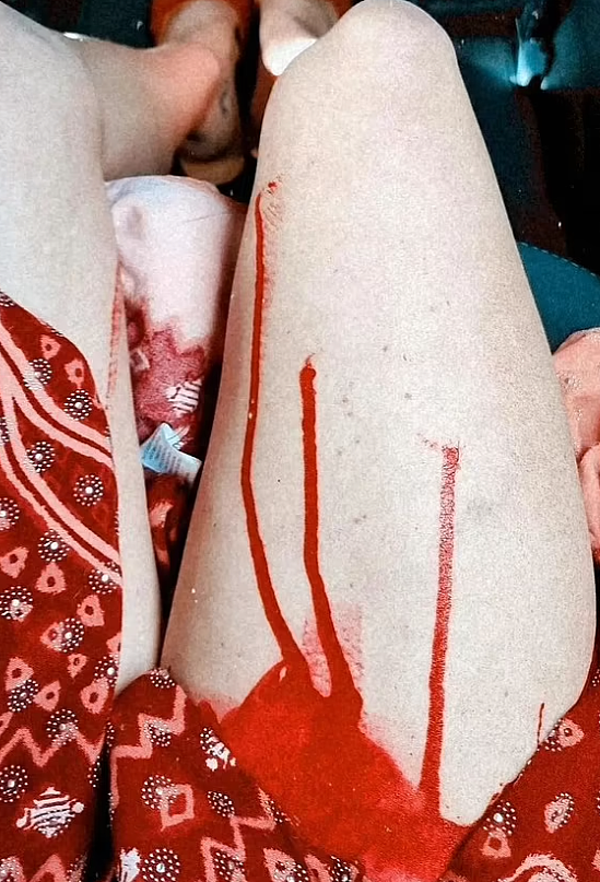 珀斯女子在LV门口裸身抗议，斥购物者“为屠杀买单”！浑身是“血”惊呆路人（视频/组图） - 3