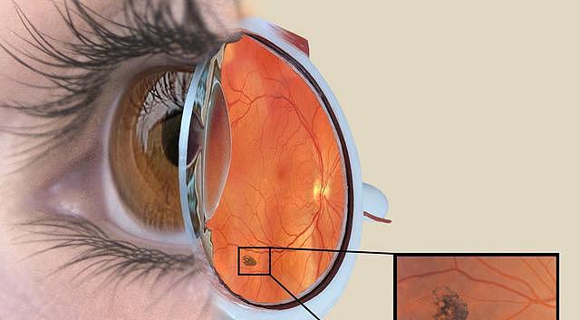 科学家用“猪皮”恢复盲人视力？科学界：细胞胶原可以生成视网膜（组图） - 1