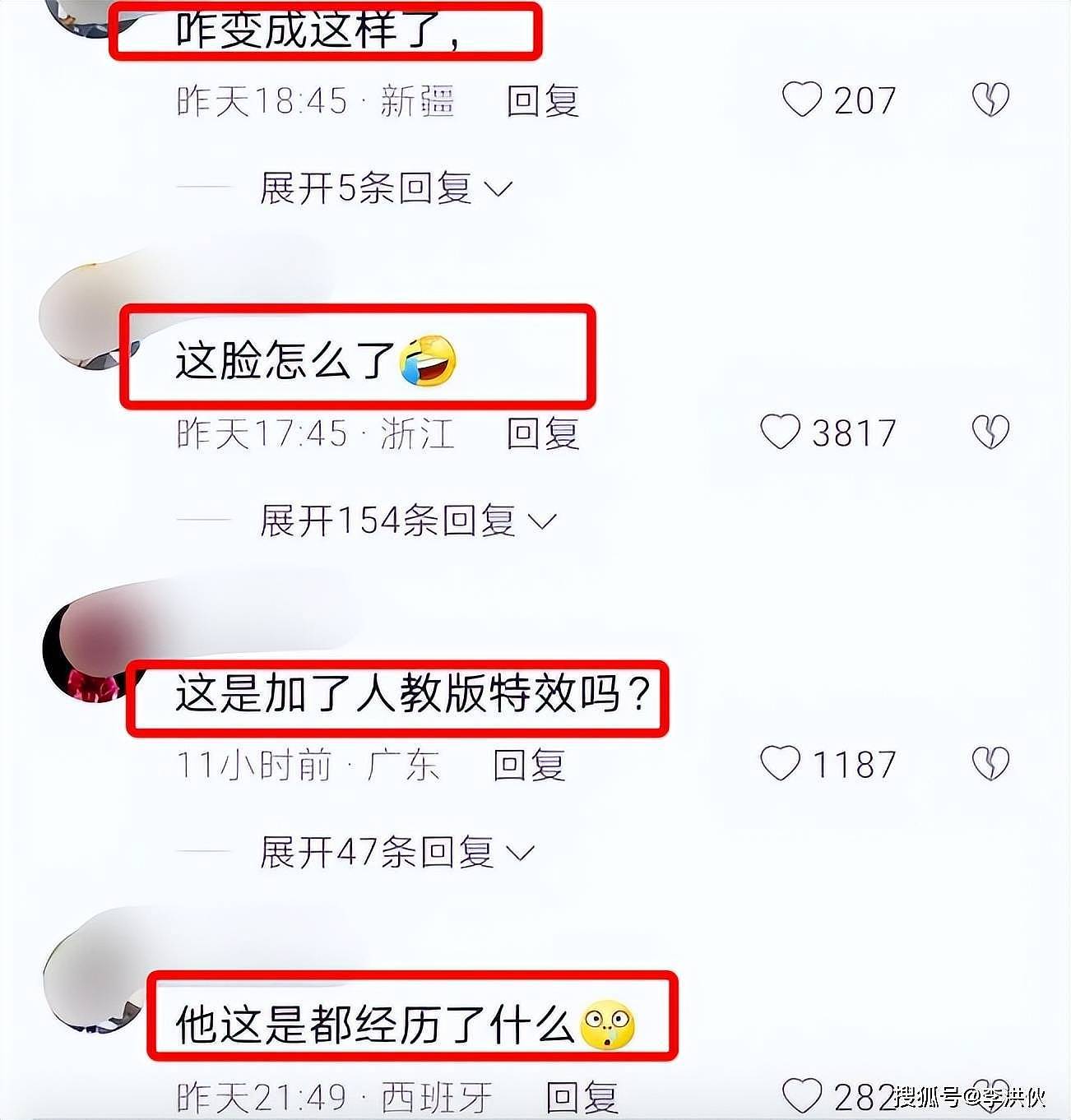 53岁歌手陈红晒近照，鼻子变形眼睛怪异五官变化大，疑似整容失败（组图） - 2