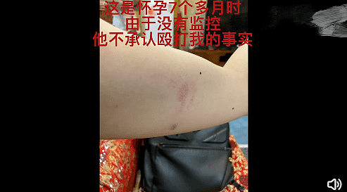 “我弄死你！” 中国男演员家暴孕妻，手掐喉咙、跳起来殴打，视频触目惊心（视频/组图） - 9