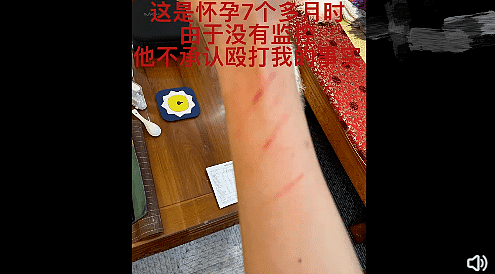 “我弄死你！” 中国男演员家暴孕妻，手掐喉咙、跳起来殴打，视频触目惊心（视频/组图） - 11