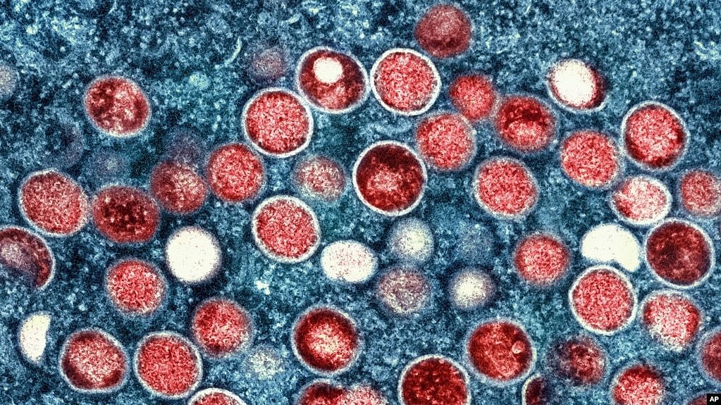 美国国家过敏及感染疾病研究院公布的猴痘（Monkeypox）病毒的彩色照片。