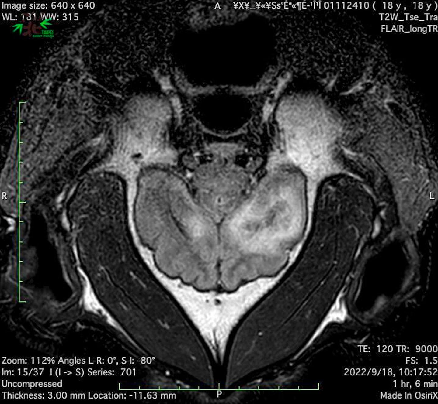 团团MRI检查影像。 （台北市立动物园）