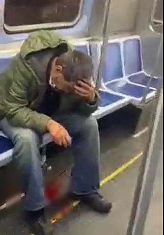 亚裔男子在芝加哥地铁上遭两名黑人抢劫殴打，血流一地（组图） - 2