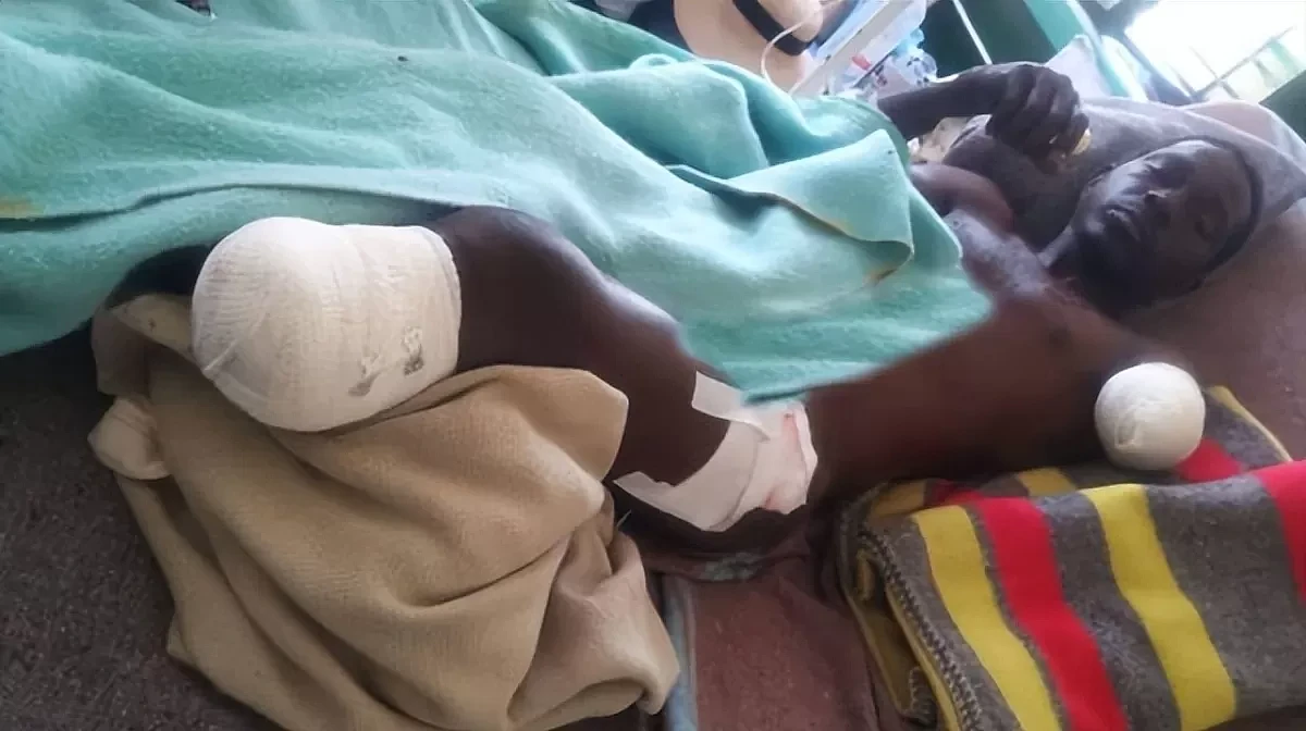 津巴布韦43岁男子为躲避大象，跳进河中，被鳄鱼咬断了手臂和腿