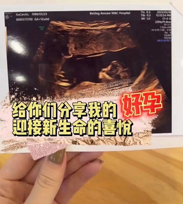 高晓松前妻夕又米晒婴儿照官宣二胎产子，与第一胎女儿相隔14年（组图） - 9