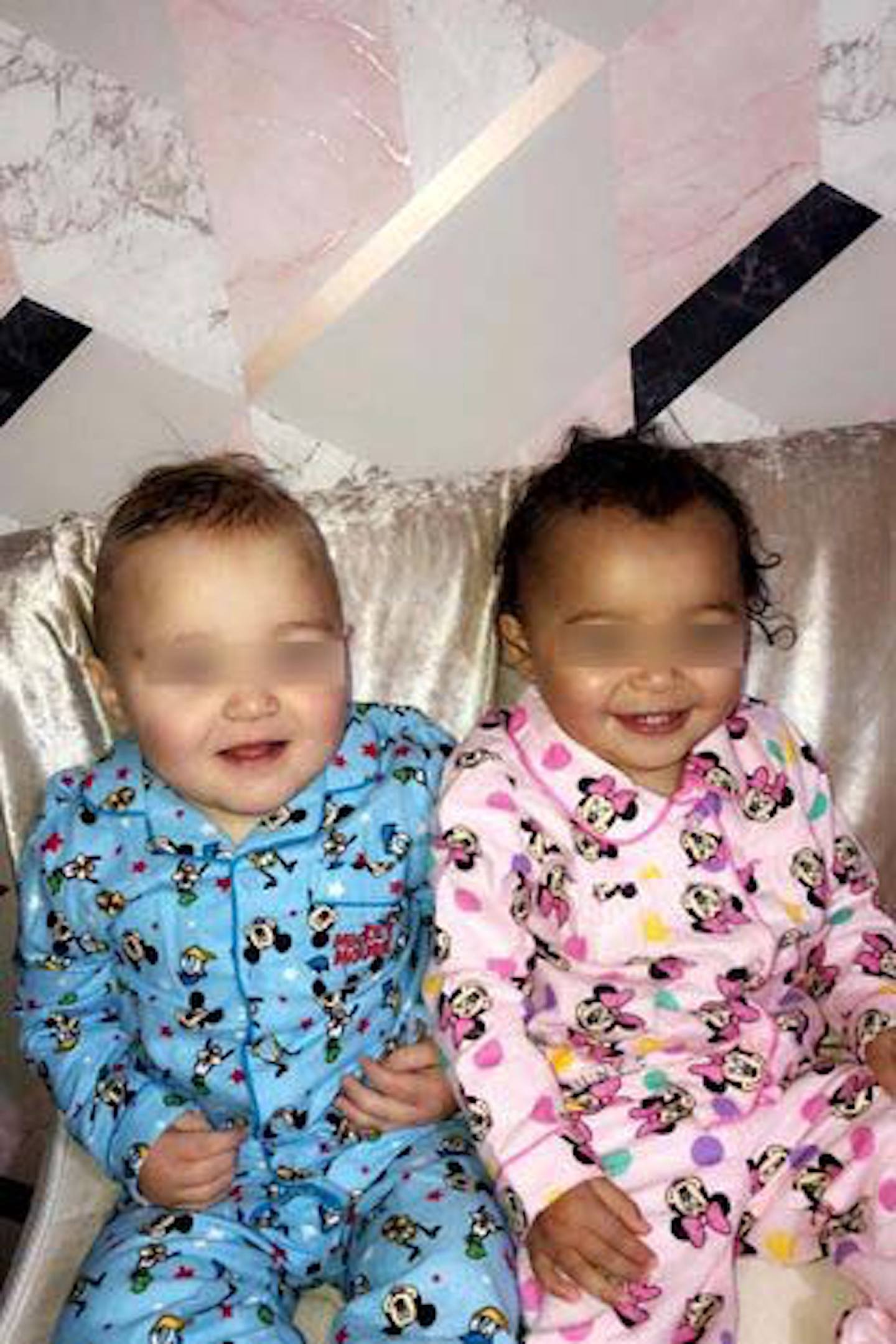 雙胞胎剛出生時看起來並沒有什麼不同，但在數個月後，膚色差異就開始顯露。（網上圖片）