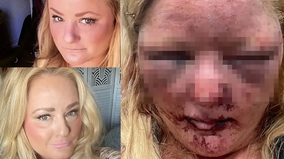 美國女子瑪莉莎（左）被歹徒毆打至面目全非（右），還遭歹徒性侵。翻攝Torrance City Police Department