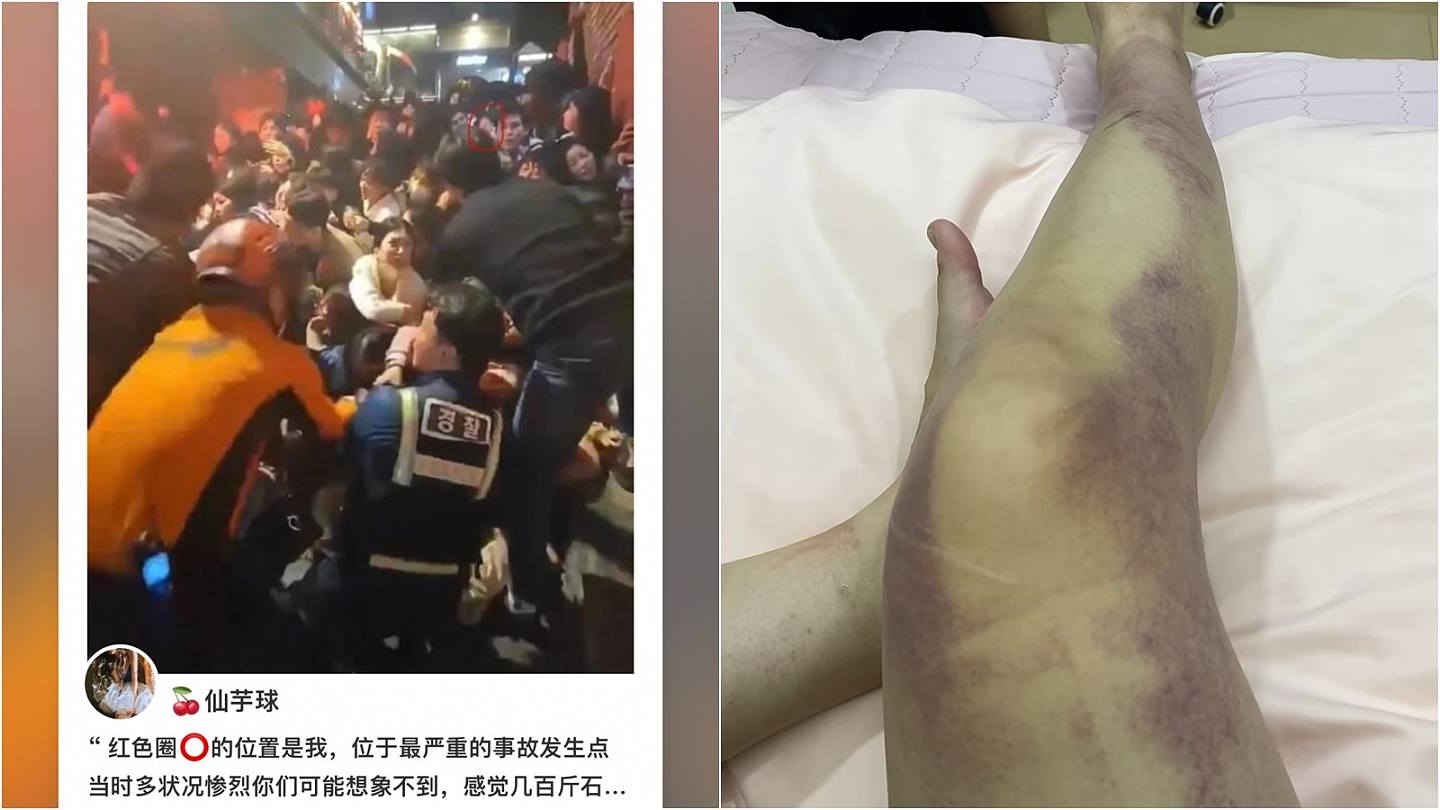 韩国踩踏事故中国留学生幸存者：如被几百斤石头压住，只能目击旁人断气（组图） - 1