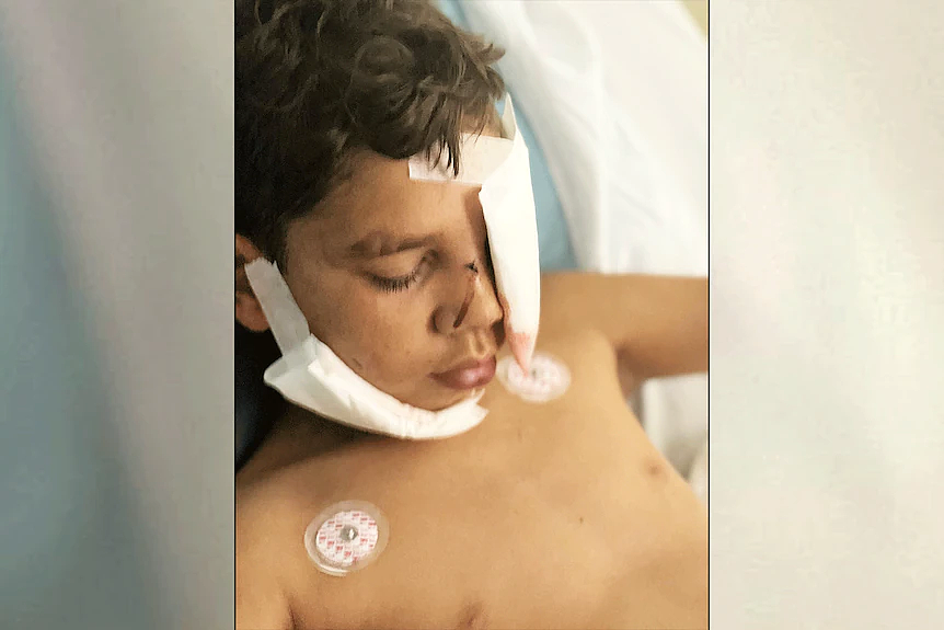 珀斯警方放警犬抓捕嫌犯，13岁男孩咬成重伤（组图） - 2