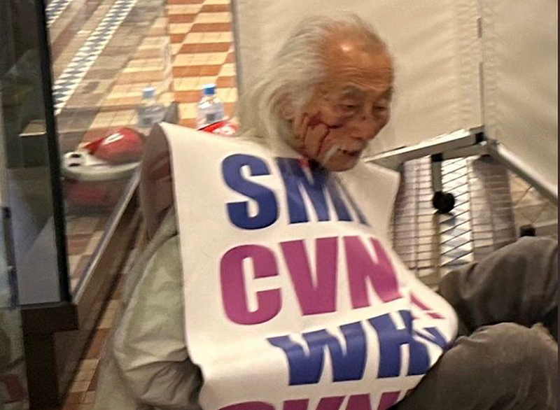 悉尼华裔老人在QVB被暴力拘捕，头朝下绊倒铐住！颧骨受伤流血送医，网友批警方“下手重”（视频/组图） - 2