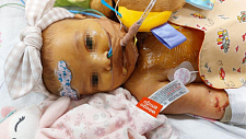 悲剧！澳女婴出生仅8周死于败血症，父母崩溃（组图）