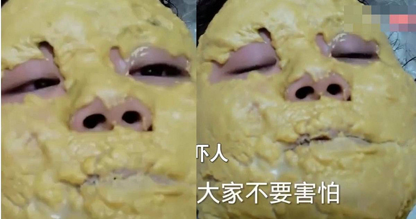 北京女发烧不退…被妈用玉米糊「敷成大饼脸」降温她惊：真的有效！