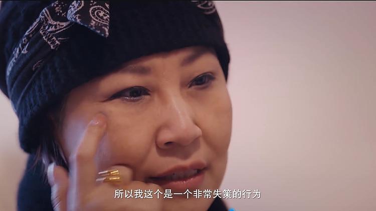 55岁歌手张蔷割双眼皮失败，术前术后对比明显，喊话医生太失望了（组图） - 2