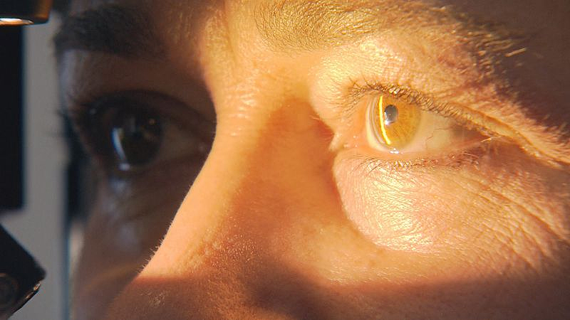 澳妈患眼黑色素瘤，眼球被摘除！专家提醒：今夏出门戴上太阳镜（组图） - 3