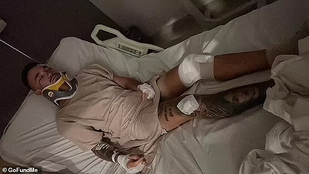 募捐$24000之后,珀斯男孩巴厘岛遇袭真相曝光：受伤源于摩托车事故（组图） - 3