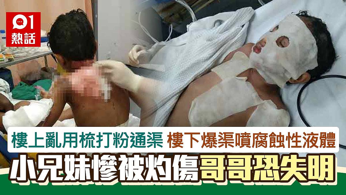 無腦鄰居！樓上亂通渠　累樓下爆炸噴腐液　9歲童灼傷毀容恐失明