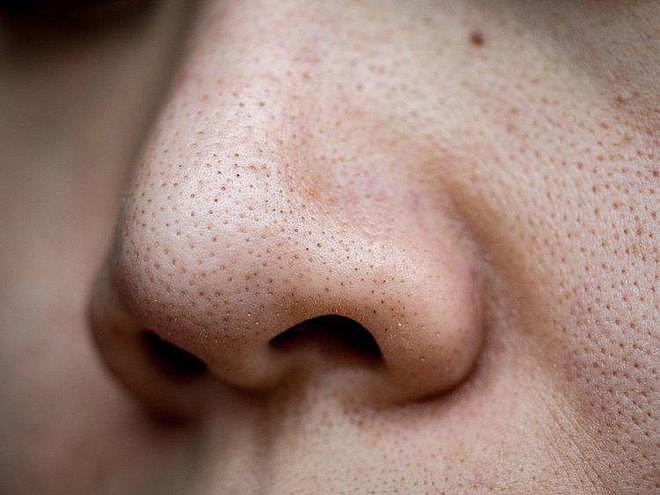 【健康】每个爱挖鼻孔的人，或早或迟可能要承受4个后果，劝你手下留情（组图） - 3