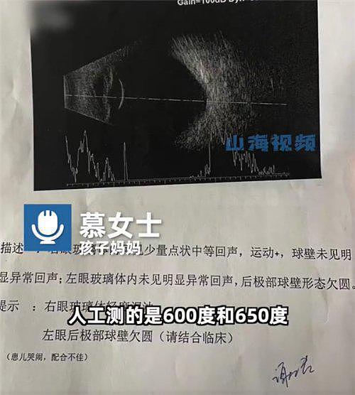 父母高度近视，1岁婴儿近视600度！恶化快速可能失明（组图） - 1