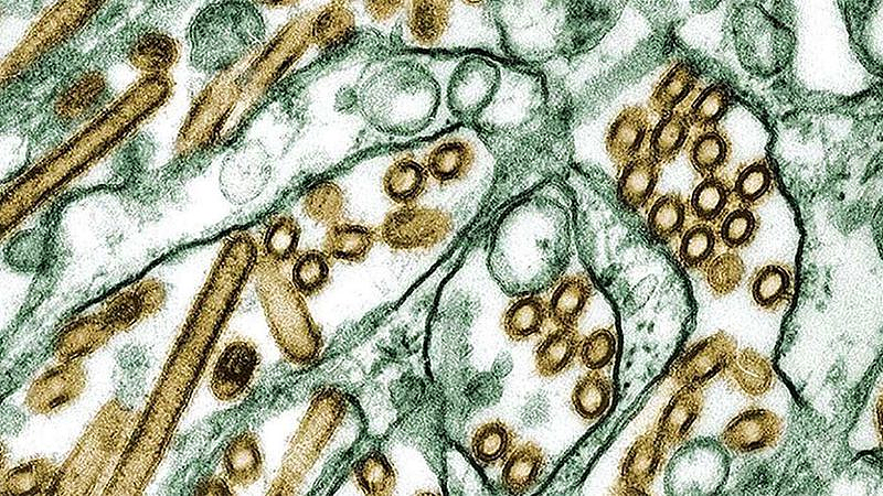 柬埔寨女童感染H5N1禽流感死亡！医生敦促澳人警惕，“碰到死鸟请远离”（组图） - 2