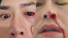 新变种Arcturus肆虐澳洲，亚裔男子感染后眼睛发炎几乎看不见！世卫警告：过去1个月逾2.3万人死亡（组图）