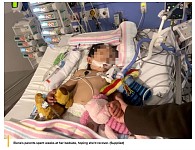 心疼！悉尼2岁华人女童突发中风，昏迷失忆，全家人都快崩溃了...（组图）