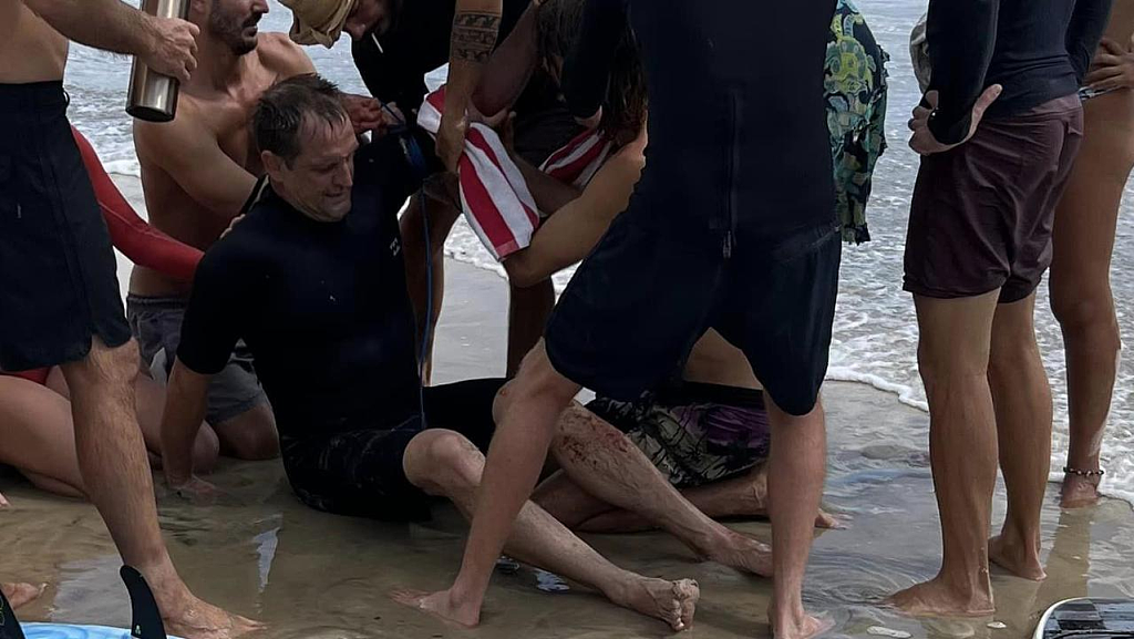 男子新州冲浪受重伤，议会或出台新规：冲浪时不系腿绳重罚$1100（组图） - 4