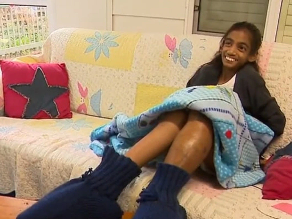 澳11岁女孩患病，双脚肿大无法行走！遇“贵人”相助获得免费药物（组图） - 3