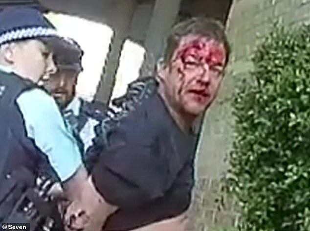 NSW Senior Constable Jay Maleckas was found guilty of unnecessarily punching and using capsicum spray on father Steven McIvor in September, 2020 (pictured, Mr McIvor following the assault)