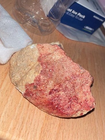 A rock was used by a group of men to attack Ms Wiseman. Picture: Supplied