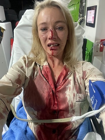 Darwin jockey Sonja Wiseman was brutally attacked by a group of men with a rock while she was in her car on Friday morning. Picture: Supplied
