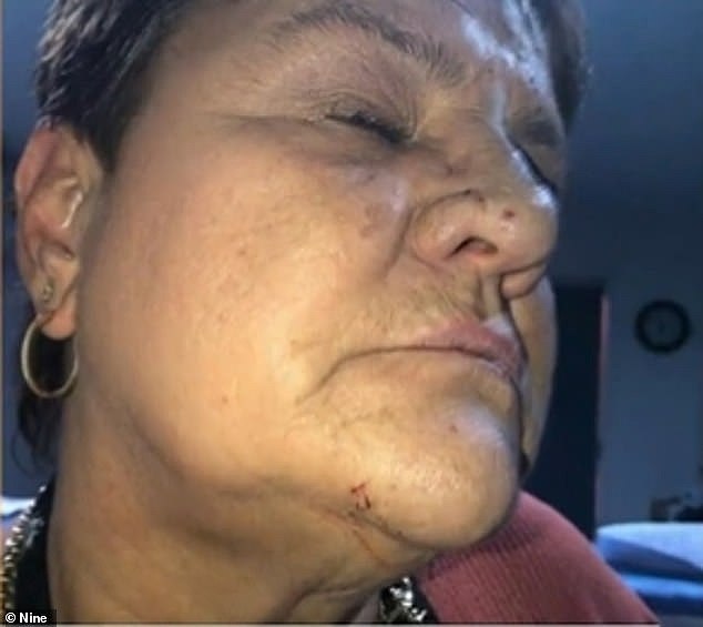 Ms Reynolds was 'petrified' and suffered cuts to her hands and face (pictured) from a wild, unprovoked road rage attack in Adelaide's north on Wednesday which was caught on camera