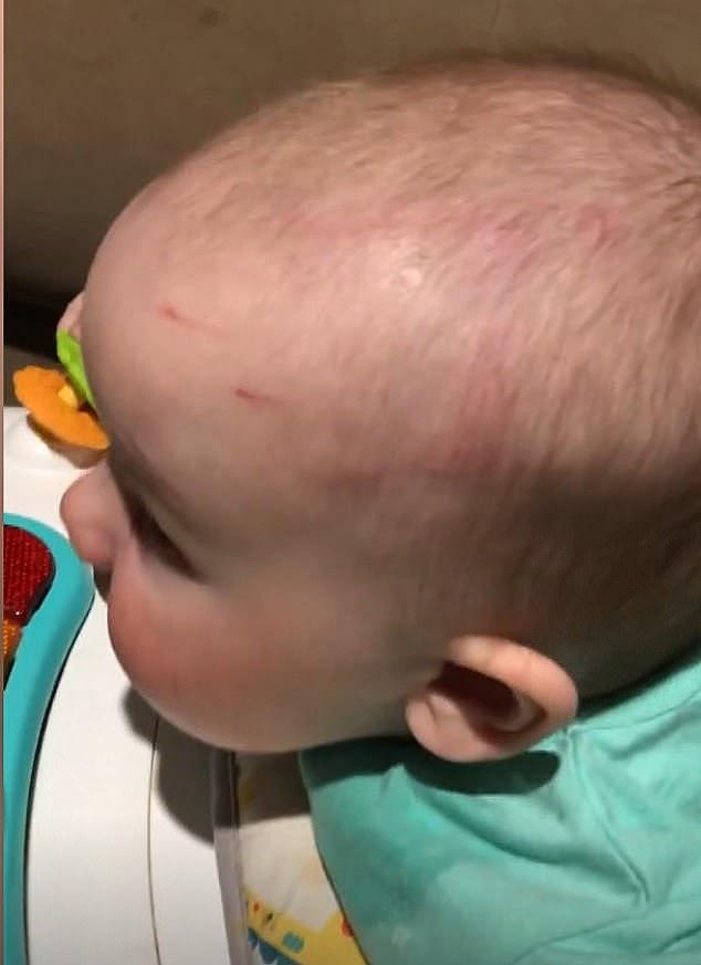 Seven-month-old Jack Swindells (pictured) was left covered in scratches and bites marks after he was attacked by an older child at his daycare while left unsupervised