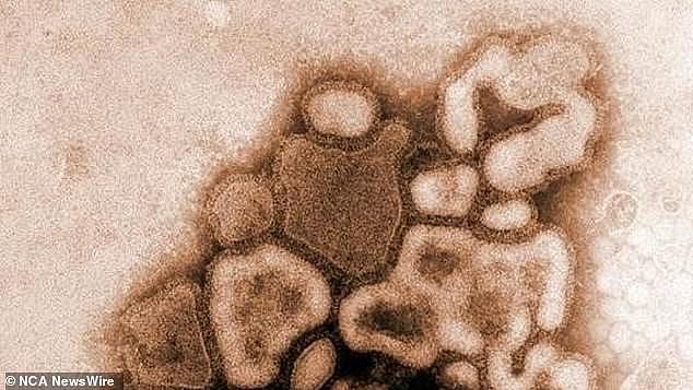 Microscope view of the H1N1 influenza (flu) strain virus