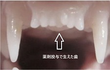 日本公司研发新药，或能帮助人类长出新牙（图）