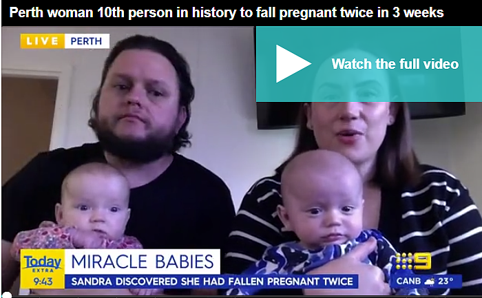世界仅10例！珀斯宝妈发生罕见“重孕”现象，18天内两次怀孕，诞下“双胞胎”（组图） - 2