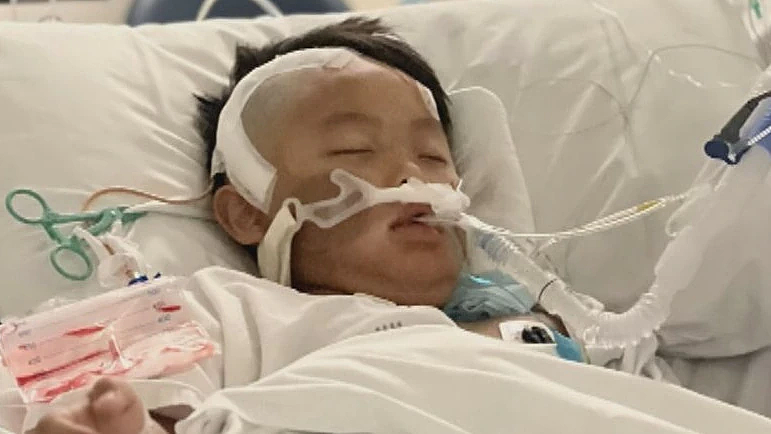 墨尔本亚裔男孩遭同学打掉牙，几天后脑出血紧急送医！父母狠批校方“不负责”（组图） - 2