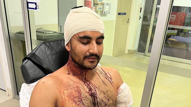 Yawinder Singh Gill was left with severe injuries after being attacked on the job last Saturday night.