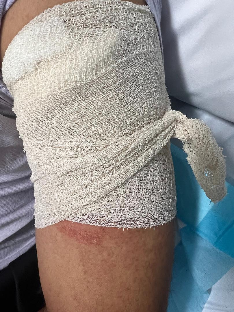 Yawinder Singh Gill is awaiting surgery in Fiona Stanley after complaining of painful numbness in his arm.